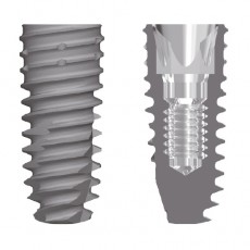 DenQ SLA Sub Fixture